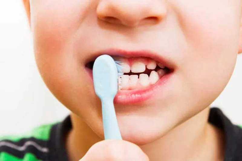 مراقبت از سلامت دندان کودکان
